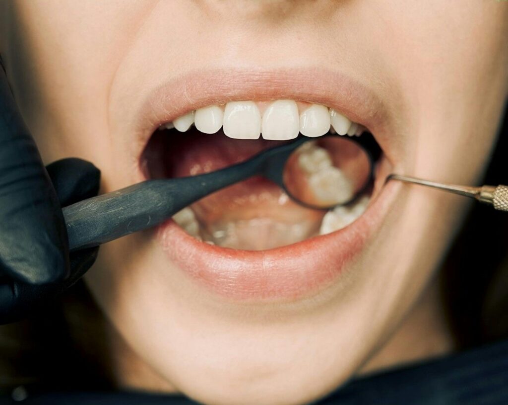 Patient receiving oral cancer screening at Inspire Dental in Dallas, Mesquite, Garland, or Balch Springs