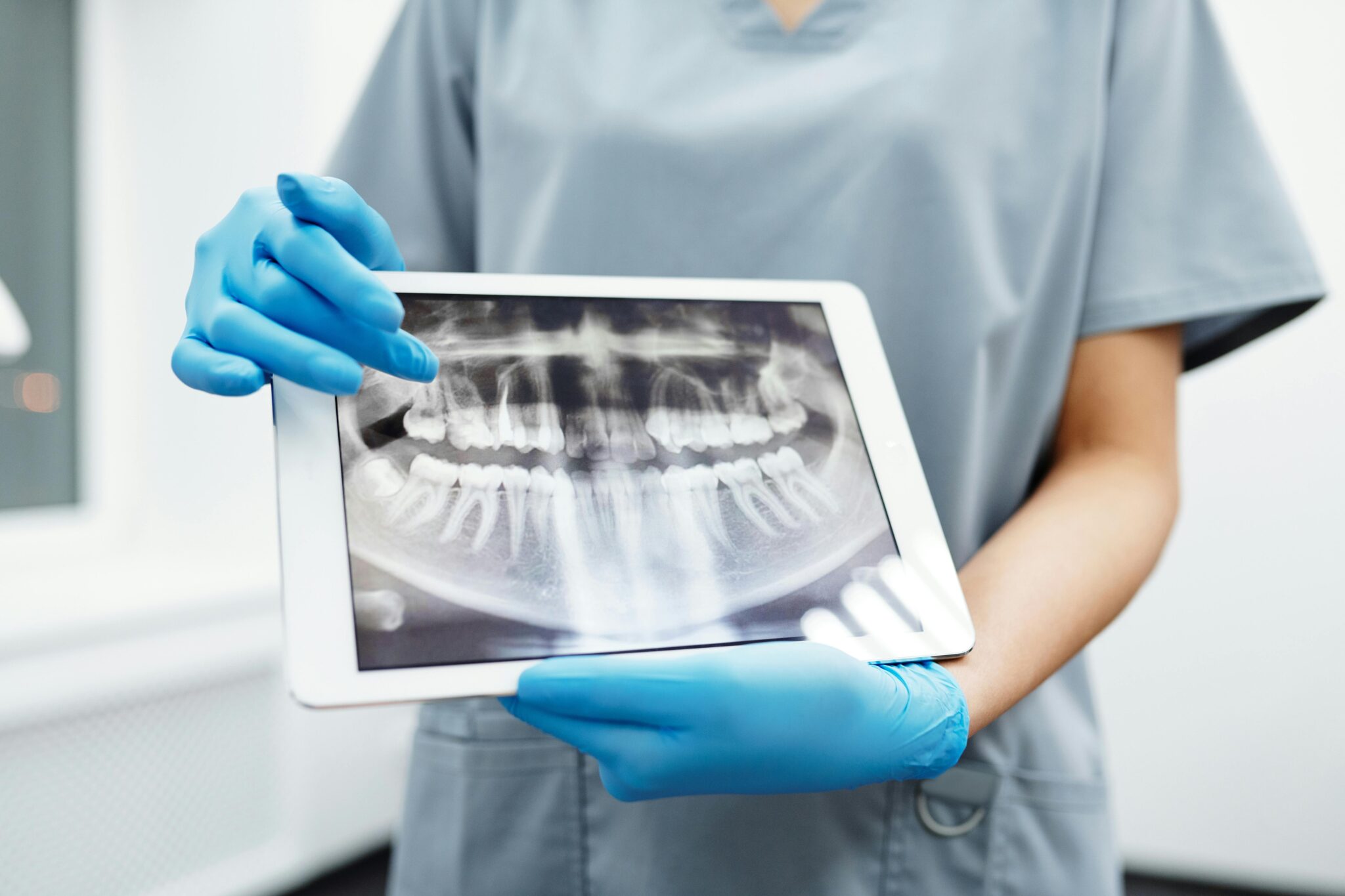Dentist performing root canal treatment at Inspire Dental in Mesquite, Garland, and Balch Springs TX