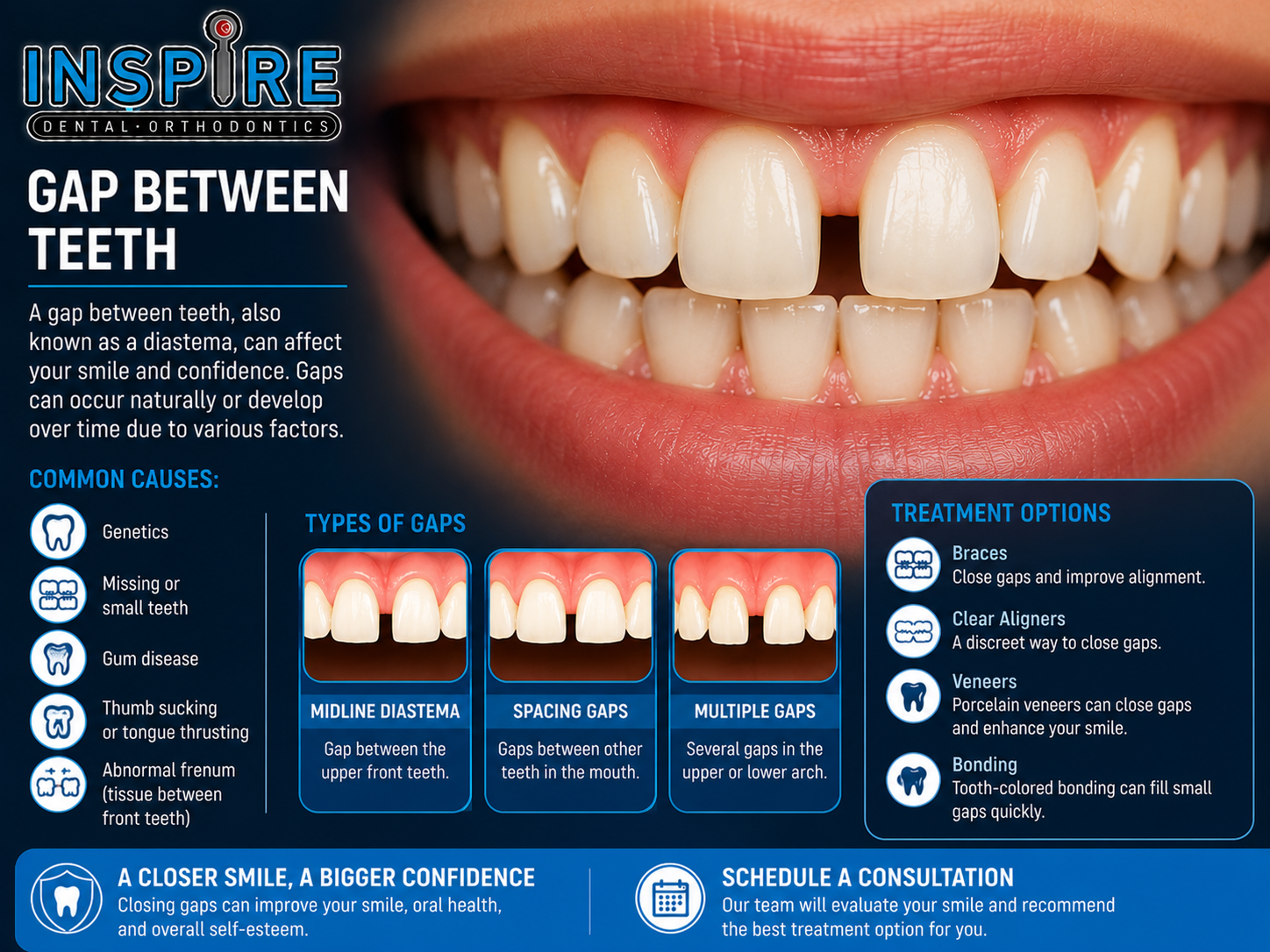 Person with a gap between their front teeth before treatment at Inspire Dental and Orthodontics