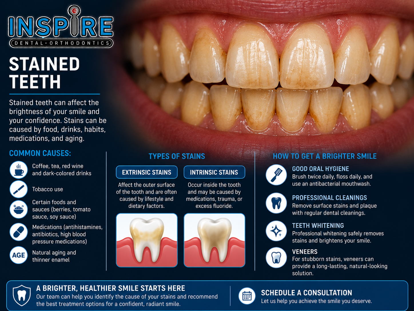Person with stained, discolored teeth before whitening treatment at Inspire Dental and Orthodontics