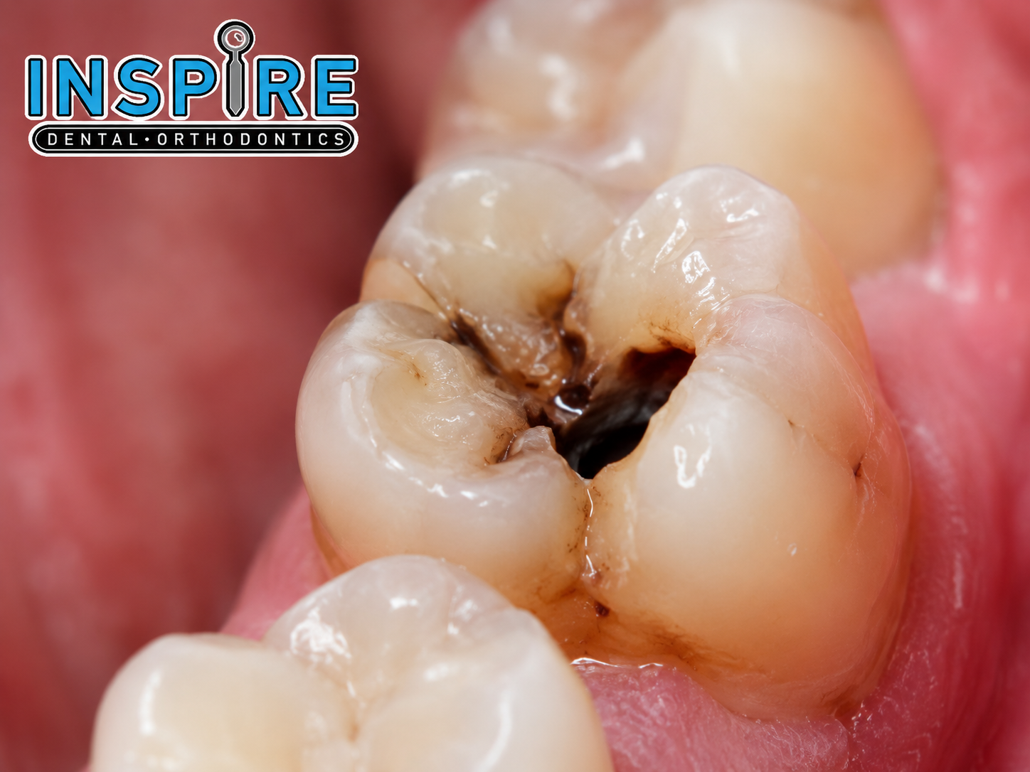 Woman holding her jaw in tooth pain before seeing a dentist at Inspire Dental and Orthodontics