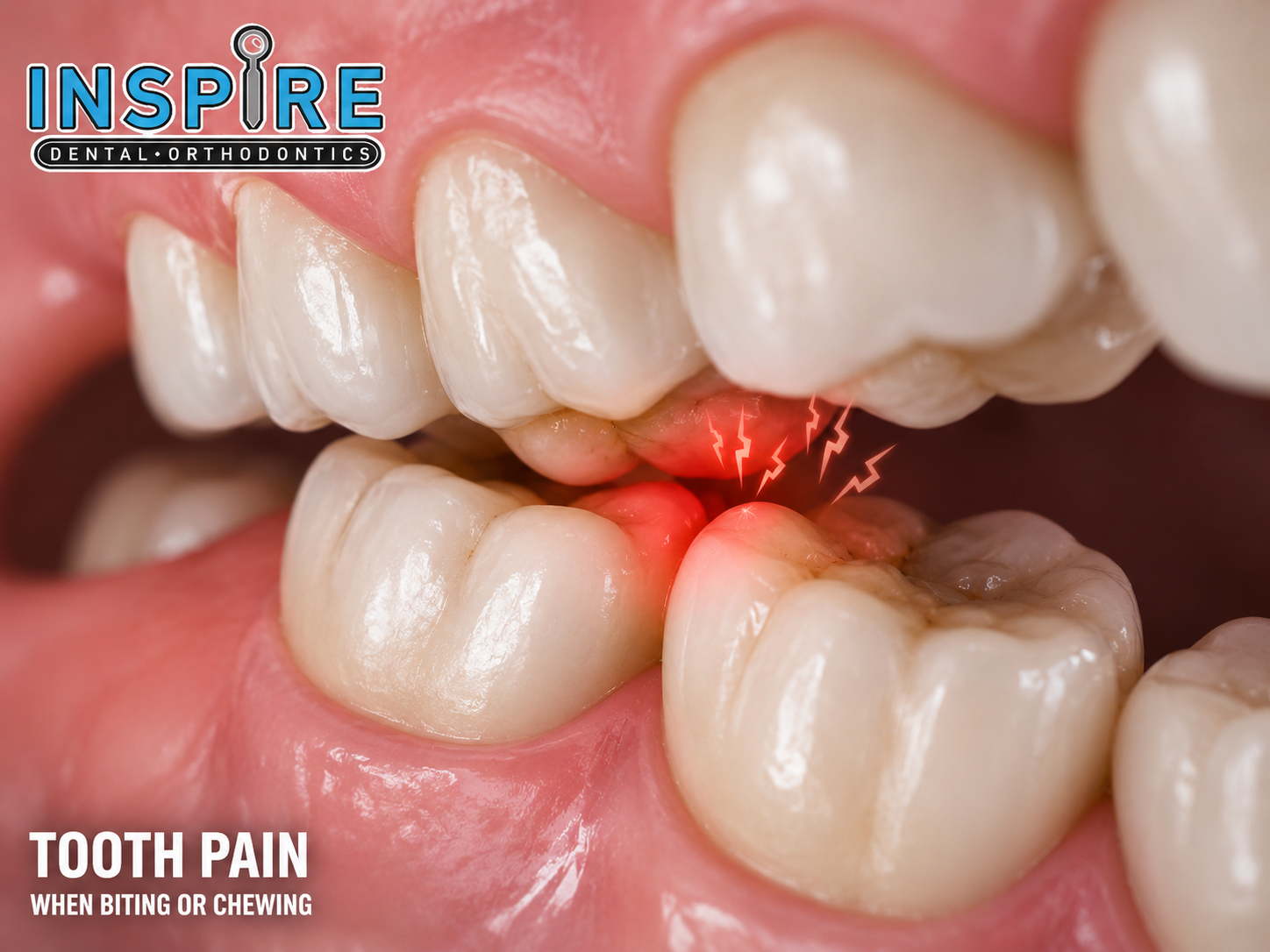 Person with tooth pain when biting or chewing food before treatment at Inspire Dental and Orthodontics